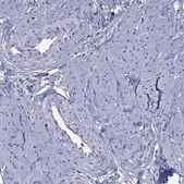 Anti-PPP1R3A antibody produced in rabbit Prestige Antibodies® Powered by Atlas Antibodies, affinity isolated antibody, buffered aqueous glycerol solution