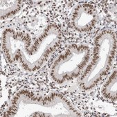 Anti-SKIV2L2 antibody produced in rabbit Prestige Antibodies® Powered by Atlas Antibodies, affinity isolated antibody, buffered aqueous glycerol solution