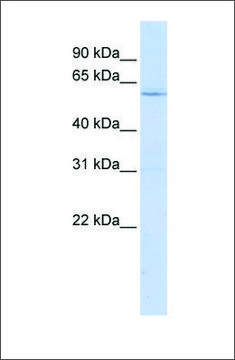 Anti-LRRC15 antibody produced in rabbit affinity isolated antibody