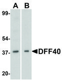Anti-DFF40 (ab3) antibody produced in rabbit affinity isolated antibody, buffered aqueous solution