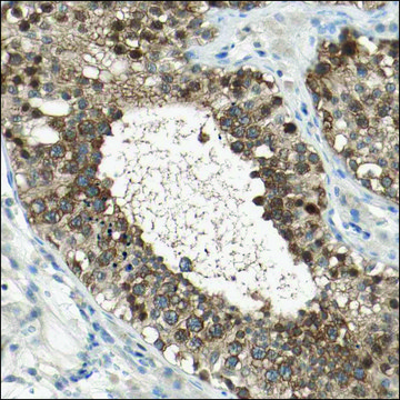 Anti-USP8 antibody produced in rabbit Prestige Antibodies&#174; Powered by Atlas Antibodies, affinity isolated antibody, buffered aqueous glycerol solution