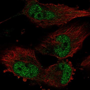 Anti-TATDN1 antibody produced in rabbit Prestige Antibodies&#174; Powered by Atlas Antibodies, affinity isolated antibody