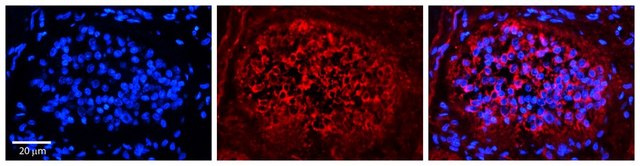 Anti-XPO1 antibody produced in rabbit affinity isolated antibody