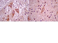 Anti-NeuroD 6 Antibody Chemicon®, from rabbit