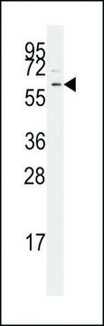 ANTI-TGF BETA RECEPTOR I (CENTER) antibody produced in rabbit IgG fraction of antiserum, buffered aqueous solution