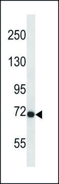 ANTI-MOUSE FGFR3 (CENTER) antibody produced in rabbit IgG fraction of antiserum, buffered aqueous solution