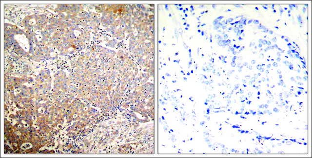 Anti-phospho-KRT18 (pSer33) antibody produced in rabbit affinity isolated antibody