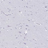 Anti-COL17A1 antibody produced in rabbit Prestige Antibodies® Powered by Atlas Antibodies, affinity isolated antibody, buffered aqueous glycerol solution
