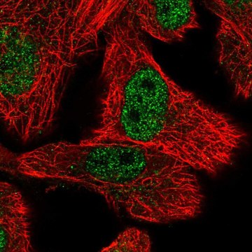 Anti-OSTC antibody produced in rabbit Prestige Antibodies&#174; Powered by Atlas Antibodies, affinity isolated antibody