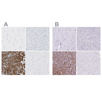 Anti-CEL antibody produced in rabbit Prestige Antibodies&#174; Powered by Atlas Antibodies, affinity isolated antibody, buffered aqueous glycerol solution