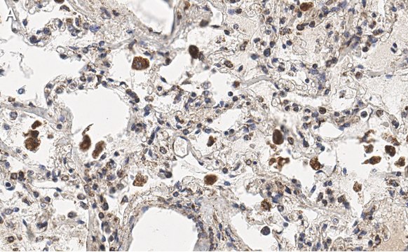 抗-MRC1抗体，克隆1C9，ZooMAb&#174;兔单克隆抗体 recombinant, expressed in HEK 293 cells