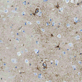 Anti-GPC1 antibody produced in rabbit Prestige Antibodies® Powered by Atlas Antibodies, affinity isolated antibody, buffered aqueous glycerol solution