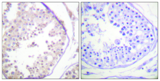 Anti-RAD52 antibody produced in rabbit affinity isolated antibody