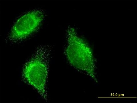 Monoclonal Anti-SFTPD antibody produced in mouse clone 2C10, purified immunoglobulin, buffered aqueous solution