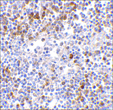 Anti-MDA5 antibody produced in rabbit affinity isolated antibody, buffered aqueous solution