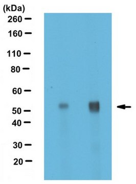 Anti-alpha Tubulin Antibody, nontyrosinated serum, from rabbit