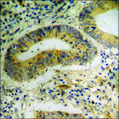 Anti-phospho-ATF4 (pSer245) antibody produced in rabbit affinity isolated antibody