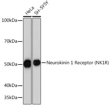 Anti-Neurokinin 1 Receptor (NK1R) Antibody, clone 9T1W2, Rabbit Monoclonal