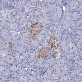 Anti-SLC30A8 Prestige Antibodies® Powered by Atlas Antibodies, affinity isolated antibody