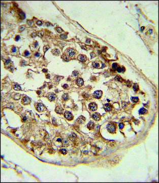 ANTI-DEPDC1 (N-TERM) antibody produced in rabbit IgG fraction of antiserum, buffered aqueous solution