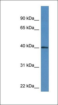 Anti-ATAD1 antibody produced in rabbit affinity isolated antibody