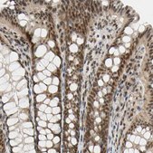 Anti-TAF4 antibody produced in rabbit Prestige Antibodies® Powered by Atlas Antibodies, affinity isolated antibody, buffered aqueous glycerol solution