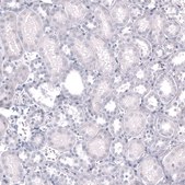 Monoclonal Anti-EOMES antibody produced in mouse Prestige Antibodies® Powered by Atlas Antibodies, clone CL15426, purified antibody (Protein A)