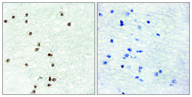 Anti-ZIC1 antibody produced in rabbit affinity isolated antibody