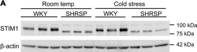 Anti-STIM1 (N-terminal) 兔抗 ~1&#160;mg/mL, affinity isolated antibody, buffered aqueous solution