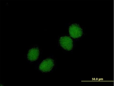 Anti-CHKB antibody produced in mouse purified immunoglobulin, buffered aqueous solution