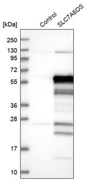 Anti-SLC7A6OS antibody produced in rabbit Prestige Antibodies&#174; Powered by Atlas Antibodies, affinity isolated antibody, buffered aqueous glycerol solution