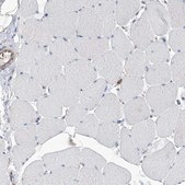 Anti-ABRACL antibody produced in rabbit Prestige Antibodies® Powered by Atlas Antibodies, affinity isolated antibody, buffered aqueous glycerol solution