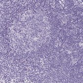 Anti-CDH16 antibody produced in rabbit Prestige Antibodies® Powered by Atlas Antibodies, affinity isolated antibody, buffered aqueous glycerol solution