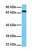 Anti-DDX41 antibody produced in rabbit affinity isolated antibody