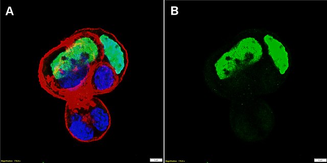 Anti-SALL4 Antibody, clone 1H18 ZooMAb&#174; Rabbit Monoclonal recombinant, expressed in HEK 293 cells