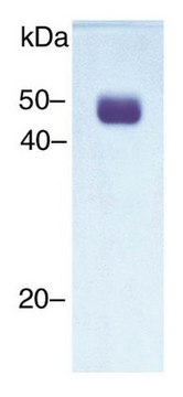 Urokinase-type Plasminogen Activator