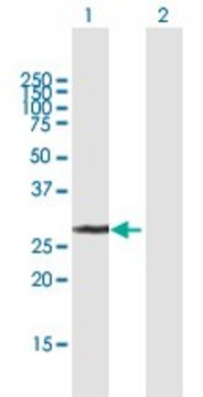 Anti-UCK2 antibody produced in mouse purified immunoglobulin, buffered aqueous solution