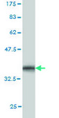 Monoclonal Anti-CHST3 antibody produced in mouse clone 1C4, purified immunoglobulin, buffered aqueous solution