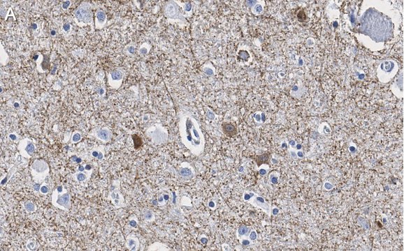 Anti-GAD65 Antibody, clone 3B23 ZooMAb&#174; Rabbit Monoclonal recombinant, expressed in HEK 293 cells