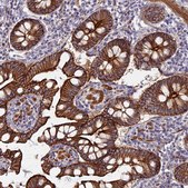 Anti-MYO5B antibody produced in rabbit Prestige Antibodies® Powered by Atlas Antibodies, affinity isolated antibody, buffered aqueous glycerol solution