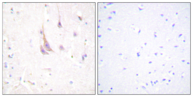 Anti-PKC &#950; antibody produced in rabbit affinity isolated antibody