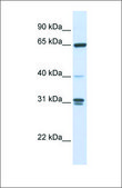 Anti-GBP2 antibody produced in rabbit affinity isolated antibody