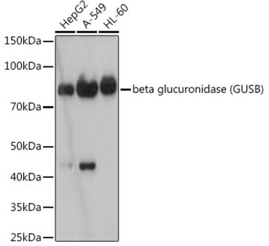 Anti-beta glucuronidase (GUSB) Antibody, clone 4U0E2, Rabbit Monoclonal