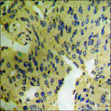 Anti-phospho-Catenin-&#946; (pTyr489) antibody produced in rabbit affinity isolated antibody