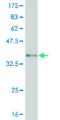 Monoclonal Anti-ARID1B antibody produced in mouse clone 2F2, purified immunoglobulin, buffered aqueous solution