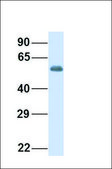 Anti-G6PD antibody produced in rabbit affinity isolated antibody