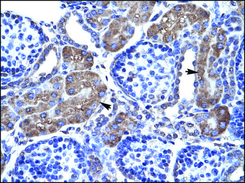 Anti-PAX7 antibody produced in rabbit affinity isolated antibody