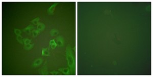 Anti-Synuclein β antibody produced in rabbit affinity isolated antibody
