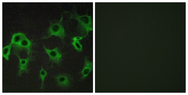 Anti-ADRB2 antibody produced in rabbit affinity isolated antibody