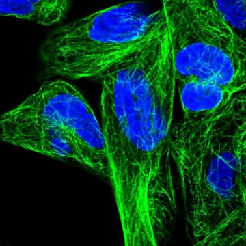 Anti-RPL6 antibody produced in rabbit Prestige Antibodies&#174; Powered by Atlas Antibodies, affinity isolated antibody